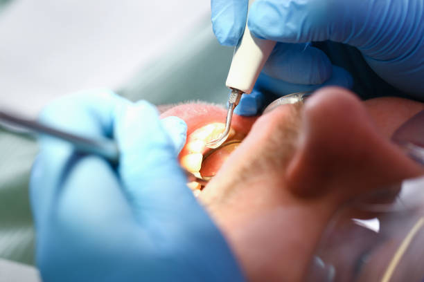Best Emergency Treatment for Dental Infections or Abscesses in Vaeboro, NC